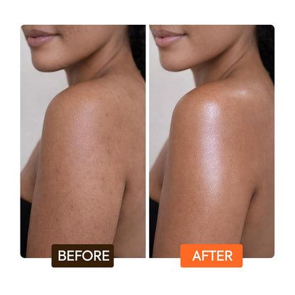 MAKARI Naturalle Carotonic Extreme Body Glycerin (16.6 oz) | Helps Brighten Skin and Fade Body Scars and Marks | Glycerin Oil for All Skin Types | Safe for Sensitive Skin and Kids Ages 12 and Up