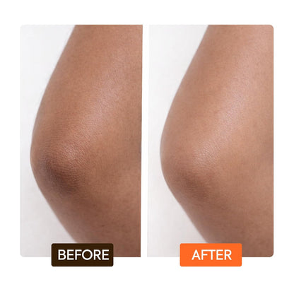 MAKARI Carotonic Extreme Body Lotion (17.6 oz) | Fights Excess Oil Production | Helps Fade Body Scars and Marks | Skin Brightening Formula | Helps Resist Aging and Promotes Healthy Radiance