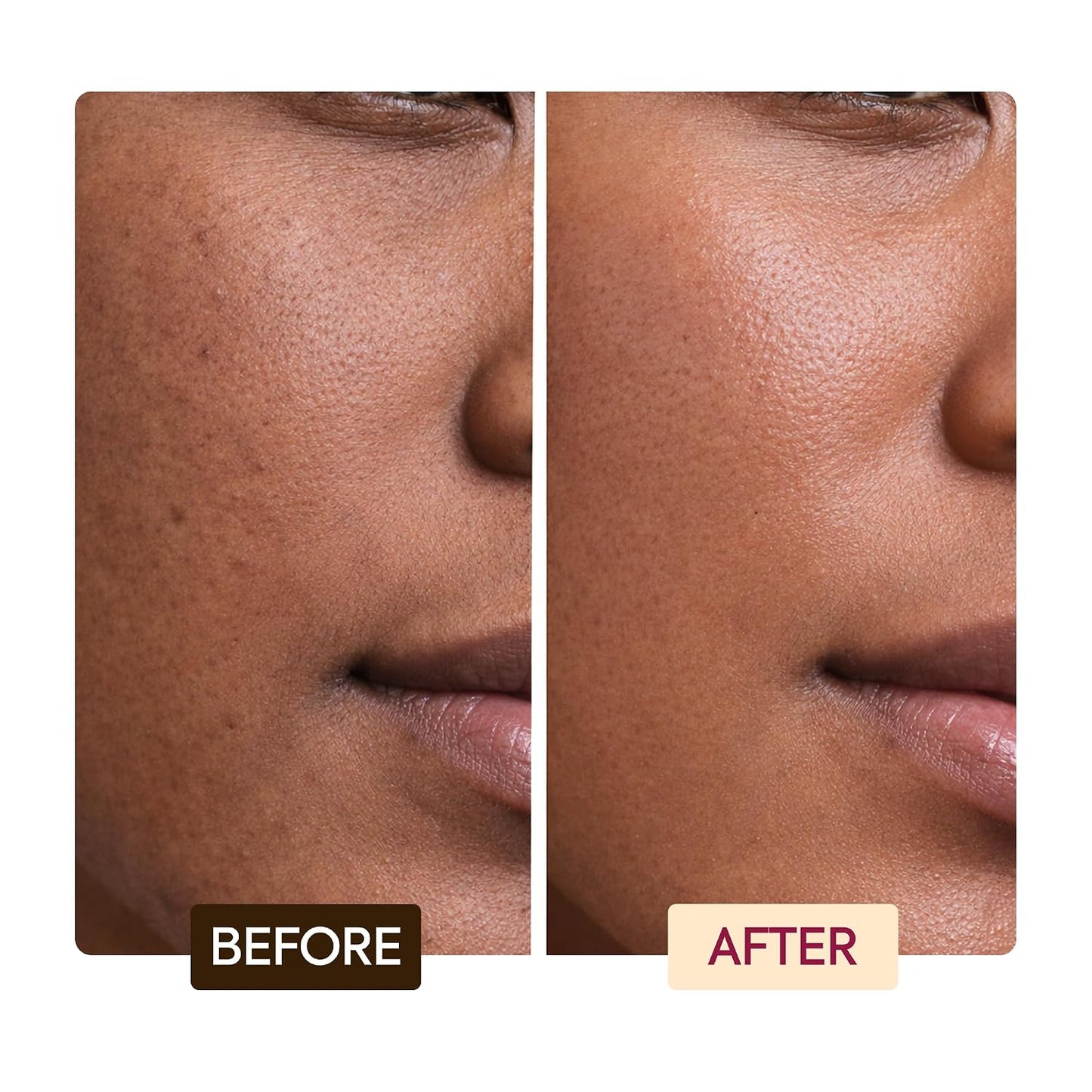MAKARI Classic Exfoliating Antiseptic Soap (7 oz) | Helps Revitalize Skin | Supports a More Even-Looking Complexion | Detoxifies & Removes Impurities